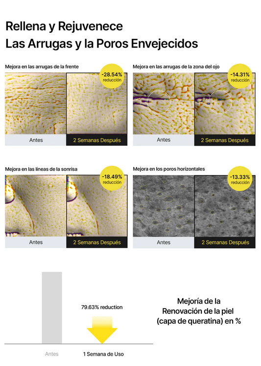 RETINAL SHOT TIGHTENING BOOSTER - CELIMAX